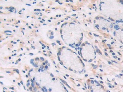 Polyclonal Antibody to Cat Eye Syndrome Chromosome Region, Candidate 1 (CECR1)