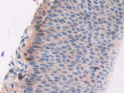 Polyclonal Antibody to Cat Eye Syndrome Chromosome Region, Candidate 1 (CECR1)