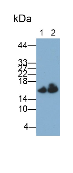 Polyclonal Antibody to Microtubule Associated Protein 1 Light Chain 3 Alpha (MAP1LC3a)