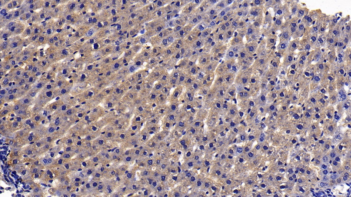 Polyclonal Antibody to Mitogen Activated Protein Kinase Kinase Kinase 7 Interacting Protein 1 (MAP3K7IP1)