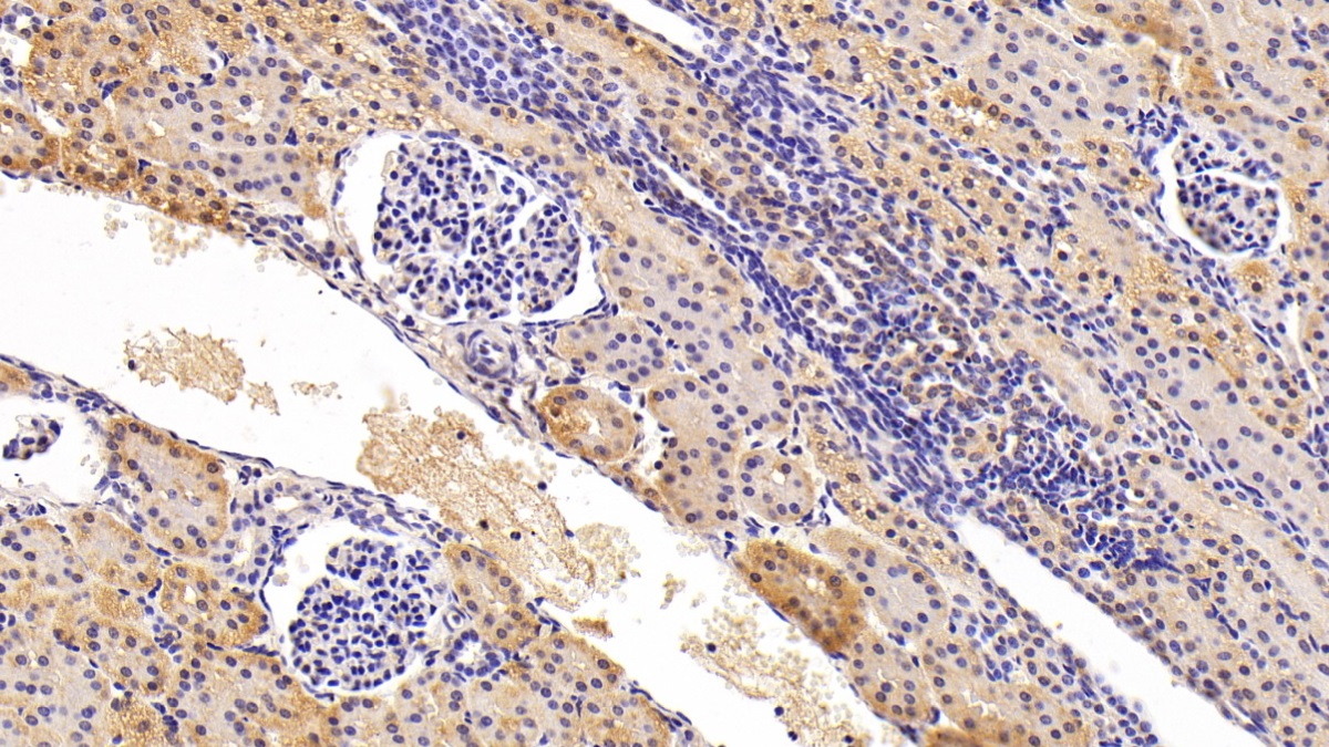 Polyclonal Antibody to Metastasis Associated In Colon Cancer 1 (MACC1)