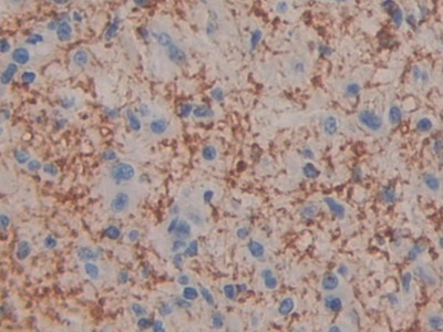 Polyclonal Antibody to Cell Death Inducing DFFA Like Effector C (CIDEC)