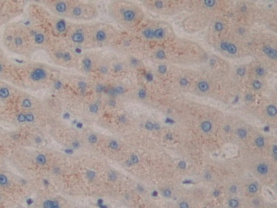 Polyclonal Antibody to Cell Death Inducing DFFA Like Effector C (CIDEC)