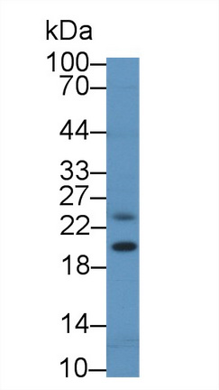 Polyclonal Antibody to Non Metastatic Cells 6, Protein Expressed In (NME6)