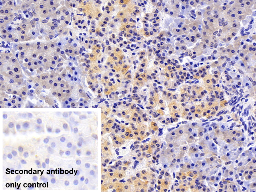 Polyclonal Antibody to Retinol Binding Protein 5, Cellular (RBP5)