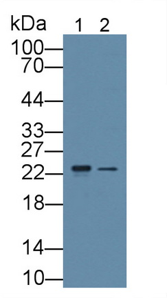 Polyclonal Antibody to Retinol Binding Protein 5, Cellular (RBP5)