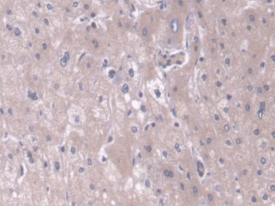 Polyclonal Antibody to Translocase Of Outer Mitochondrial Membrane 70A (TOMM70A)