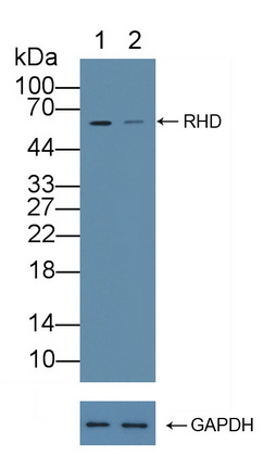 Polyclonal Antibody to Rh Blood Group, D Antigen (RHD)