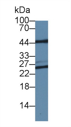 Polyclonal Antibody to Proteasome 26S Subunit, Non ATPase 8 (PSMD8)
