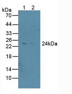 Polyclonal Antibody to Proteasome 26S Subunit, Non ATPase 10 (PSMD10)