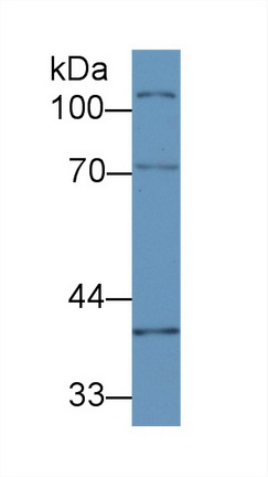 Polyclonal Antibody to CUB And Zona Pellucida Like Domains Protein 1 (CUZD1)