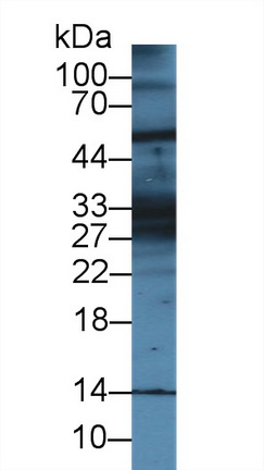 Polyclonal Antibody to Keratin 28 (KRT28)