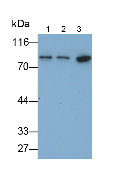 Polyclonal Antibody to RIO Kinase 1 (RIOK1)