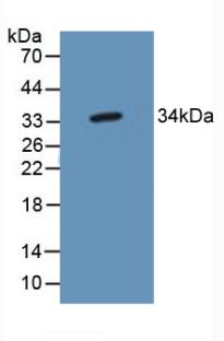Polyclonal Antibody to TP53 Target Gene 5 (TP53TG5)