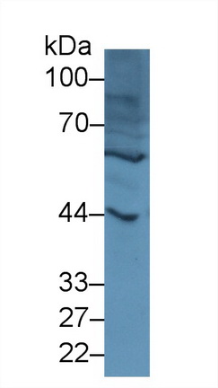 Polyclonal Antibody to Galectin 9C (GAL9C)