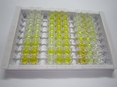 ELISA Kit for Alpha-1-Microglobulin (a1M)