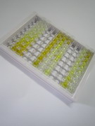 ELISA Kit for Neutrophil gelatinase-associated lipocalin (NGAL)
