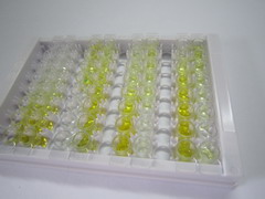 ELISA Kit for Orosomucoid 2 (ORM2)