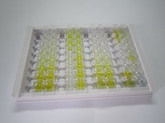 ELISA Kit for Vitamin D Binding Protein (DBP)