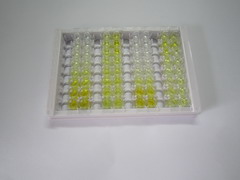 ELISA Kit for Metallothionein 2 (MT2)