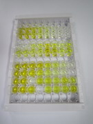 ELISA Kit for S100 Calcium Binding Protein P (S100P)