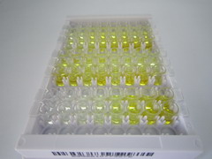ELISA Kit for Argininosuccinate Synthetase 1 (ASS1)