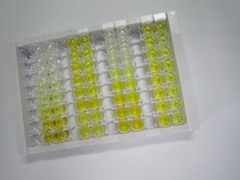ELISA Kit for 2',5'-Oligoadenylate Synthetase 1 (OAS1)