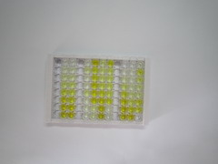 ELISA Kit for Thymidine Kinase 1, Soluble (TK1)