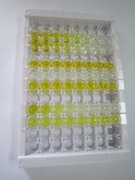 ELISA Kit for Deiodinase, Iodothyronine, Type II (DIO2)
