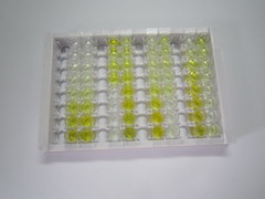 ELISA Kit for Ferritin, Light Polypeptide (FTL)