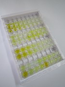 ELISA Kit for Carbonic Anhydrase III, Muscle Specific (CA3)