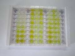 ELISA Kit for Cytochrome P450 1B1 (CYP1B1)