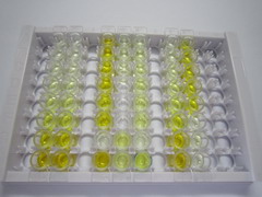 ELISA Kit for Asparagine Synthetase (ASNS)