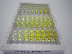 ELISA Kit for Glutamine synthetase (GS)