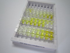 ELISA Kit for Dimethylarginine Dimethylaminohydrolase 2 (DDAH2)