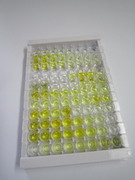 ELISA Kit for N-Acylethanolamine Acid Amidase (NAAA)