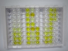 ELISA Kit for Carboxypeptidase N1 (CPN1)