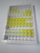 ELISA Kit for Folate Receptor 1, Adult (FOLR1)