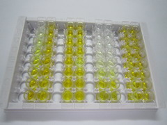 ELISA Kit for Arylsulfatase A (ARSA)
