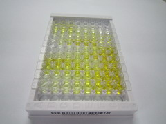 ELISA Kit for Urinary Trypsin Inhibitor (UTI)