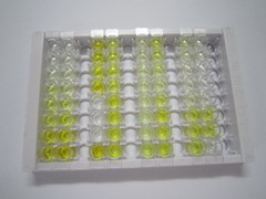 ELISA Kit for Steroid 5 Alpha Reductase 2 (SRD5a2)