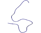 Alpha-2-Heremans Schmid Glycoprotein (AHSG)