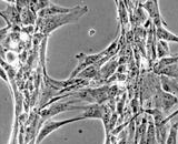 Cardiac Fibroblasts (CF)