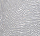Cerebral Microvascular Smooth Muscle Cells ( CMSMC)