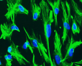 Choroid Plexus Epithelial Cells (CPEC)