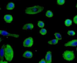 Colonic Epithelial Cells (CEC)