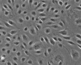 Corneal Endothelial Cells (CEC)