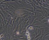 Embryonic Fibroblasts (EF)