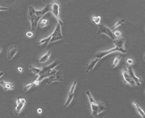 Lung Squamous Cell Carcinoma Cells (LSCC)