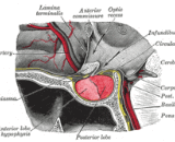 Hypothalamic Syndrome (HS)